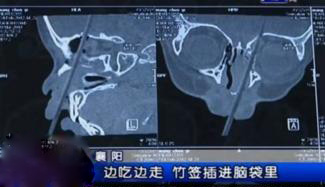 说说生活中容易忽视的安全隐患,日常生活中有哪些安全隐患