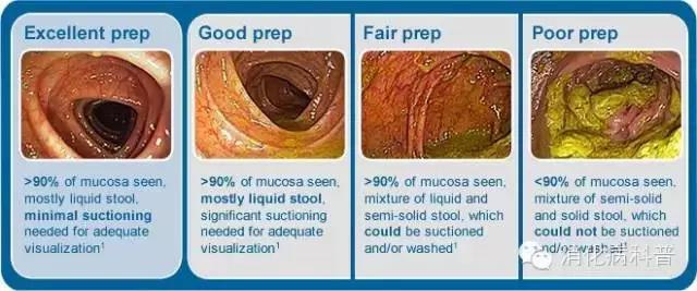 透析病人如何做肠镜肠道准备,做胃肠镜肠道准备不好怎么办