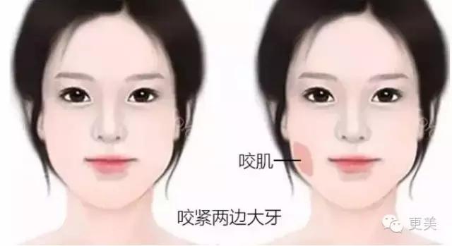 什么瘦脸霜最快最有效,瘦脸霜有用吗