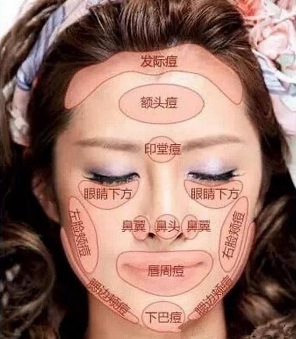 脸上的痘痘对应的内脏,痘痘真的和内脏有关系吗