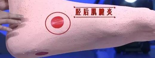 从脚看出疾病征兆,脚型不好看是怎么回事