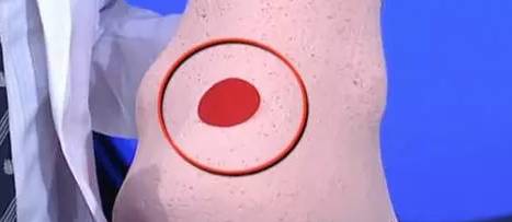 从脚看出疾病征兆,脚型不好看是怎么回事