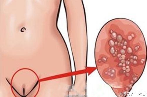 hpv检测e6e7阳性是什么意思,hpv检测阳性之后怎么办