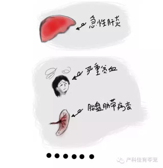 羊水过多和过少的原因,怎么预防羊水过多或过少