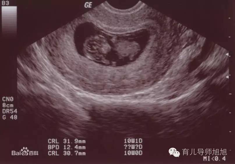 新生儿全身恶臭口吐白沫，家人痛哭但医生却说是妈妈害的