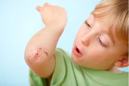 磕了碰了吃什么消炎药,磕了碰了用什么药好