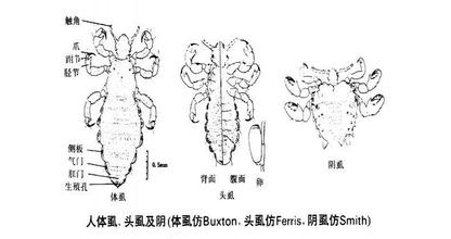 得了阴虱病治疗几天可以治愈,阴虱啥病