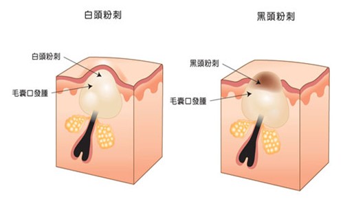 中医入门如何辨别肝的疾病,中医把脉说病是肝的问题