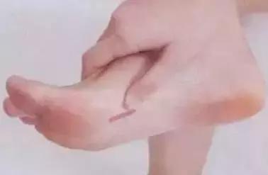 腹胀腰胀失眠是什么症状,腹胀失眠是怎么回事吃什么药