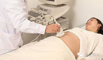 产后42天复查都检查什么挂什么科,产后42天检查可以推迟几天再做吗