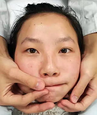 歪嘴改善动作,歪嘴巴治疗方法图片视频播放