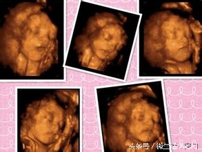 孕检时的各种问题,孕检三大注意事项