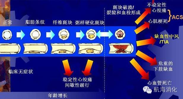 阿司匹林氯吡格雷肠道出血,阿司匹林和氯吡格雷伤胃怎么办