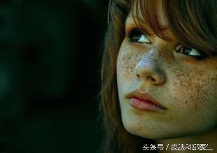 脸上长了一个圆圆的褐色斑点,如花似玉的年纪60岁的脸