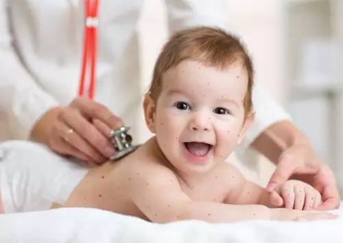 荨麻疹煮水,一味中药治荨麻疹特效药方