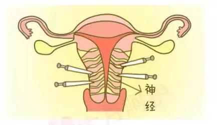 女人生孩子为什么会痛？