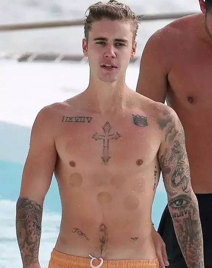 作为一个有同样爱好的老陕我必须提醒菲尔普斯:拔罐后不能下水！