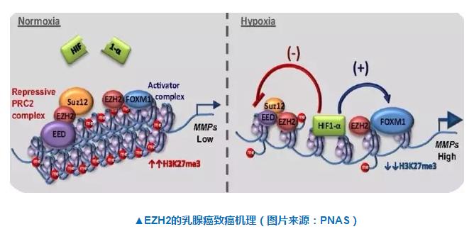 乳腺癌跟淋巴癌会同时存在么,乳腺癌和淋巴癌有关联吗
