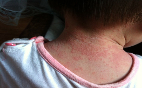 完美芦荟胶功用,你知道芦荟胶的妙用吗