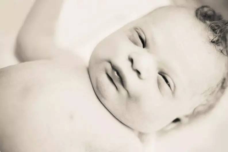 小孩患唐氏综合征,唐氏综合征比较幸运的孩子