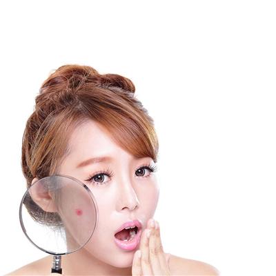 *疮痤**怎么治疗小窍门有哪些