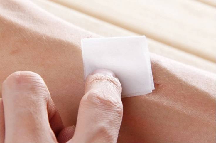 第一次刷酸去黑头新手教程,黑头处理工具用法