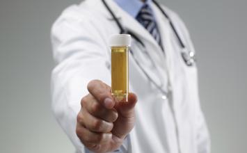 一秒看懂尿液检验报告单,读懂尿常规化验单