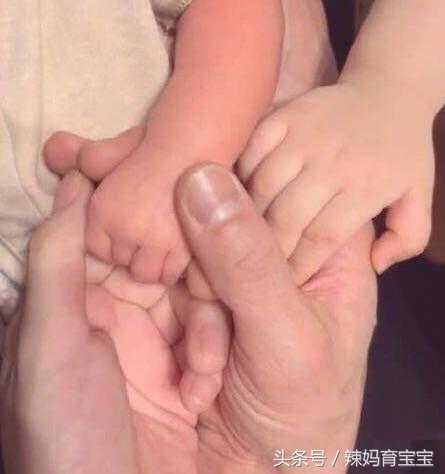 高龄产妇怀上二胎需要什么吗,高龄产妇需要做产后修复吗