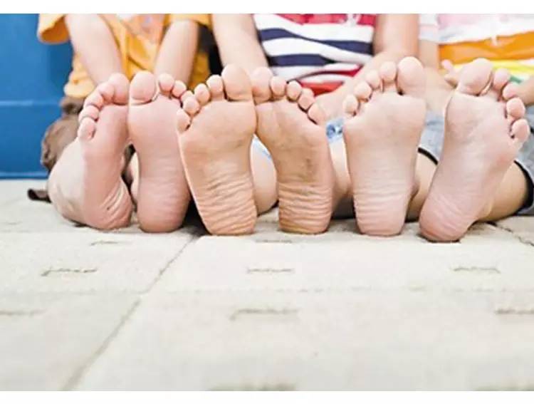 宝宝脚起像水泡一样的皮怎么回事,宝宝脚长满水泡