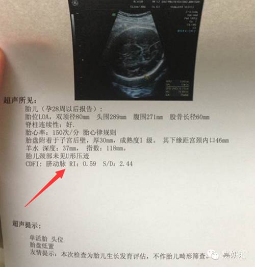 产科b超报告怎么看是否需要清宫,怎么看懂产检b超单