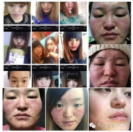 张庭现身微商宣传活动,张庭最新微商消息