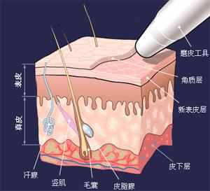 马油祛疤痕吗,马油真的可以去鸡皮肤吗