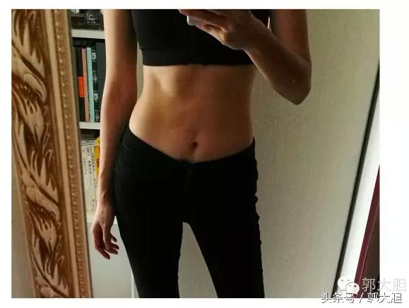 当你以为抗老还要靠超声刀的时候，我去打了更牛X的热拉提