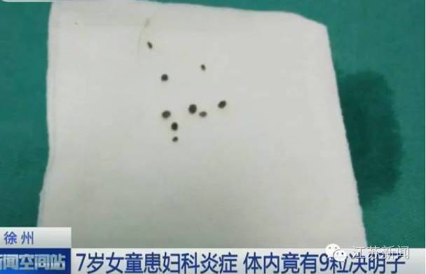6岁女童*体下**取出10件异物！转给身边家长，孩子不是这样带的！