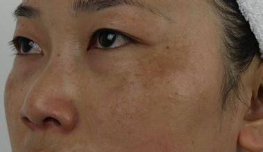 美白丸怎么用才是正确的,真正有效的美白丸产品