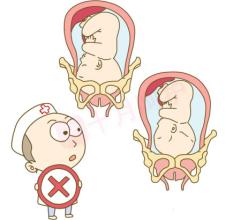 头盆不称,什么叫头盘不称