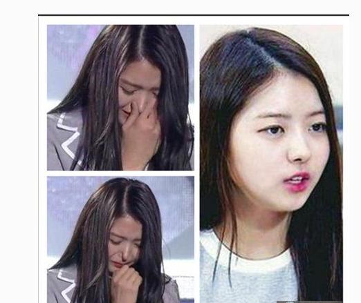 香港最老明星整容失败照片对比,整容失败的明星有哪些