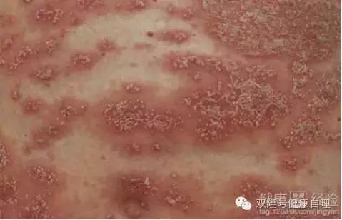 中医说吃醪糟的好处,中医说伤阴最严重症状