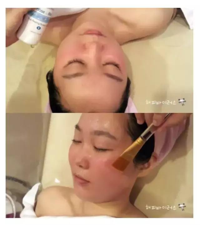 美肤祛斑知识,美肤换肤