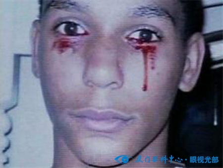 关于眼屎你还知道哪些知识,通过眼睛识人的口诀