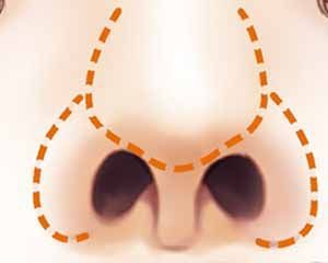 大鼻子不好看咋办,大鼻子好看还是小鼻子好看