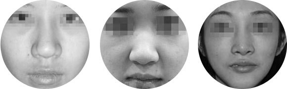 大鼻子不好看咋办,大鼻子好看还是小鼻子好看