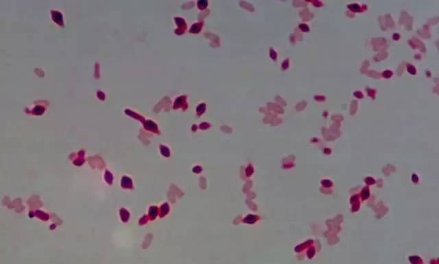 农药苏云金杆菌哪儿有,苏云金杆菌的主要功能