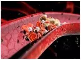 复发性流产的病因主要有,复发性流产根源