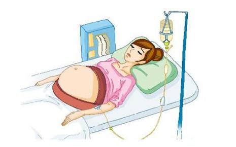 怎样避免脐带脱垂,脐带脱垂防治措施