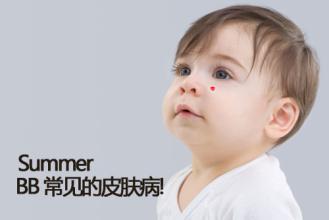 宝宝得了湿疹怎么办呢科普视频,宝宝很严重的湿疹该如何治疗