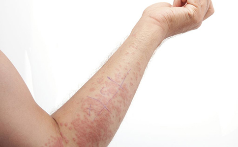 多脏器功能损伤是什么引起的,多脏器受累的疾病都有哪些