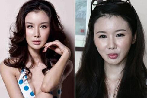 6位被整容毁掉的女星,整容把脸整得很奇怪的女星