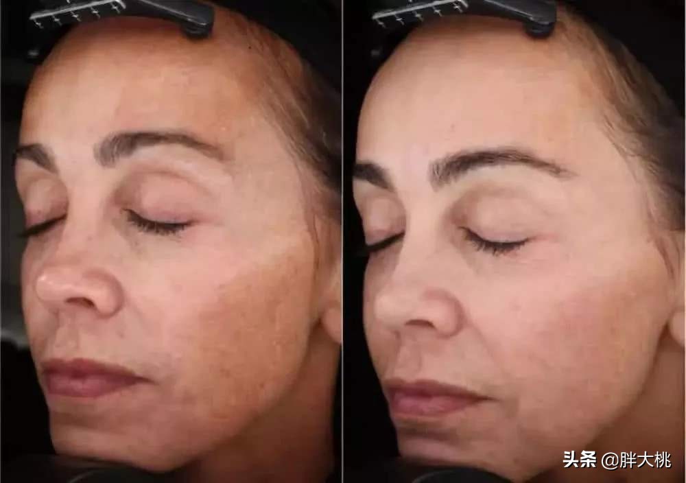 舒淇同款贵妇膏,舒淇地素同款