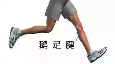 鹅足肌腱炎的治疗原理,鹅足肌腱炎的缓解手法